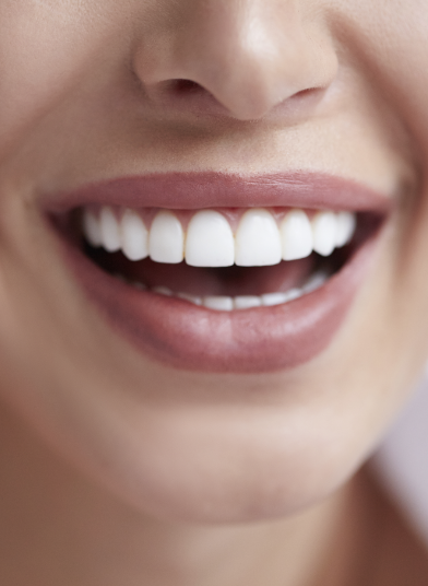 a women smiling after having a teeth straightening treatment