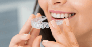 woman holding Invisalign aligners in front of her teeth at Beeston Dental Practice