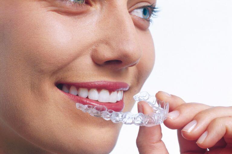woman holding a retainer next to her mouth